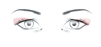 olhos-caidos